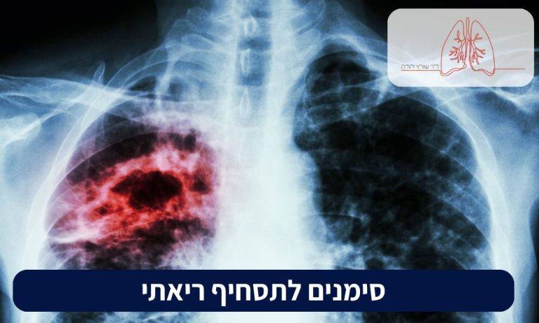 סימנים לתסחיף ריאתי