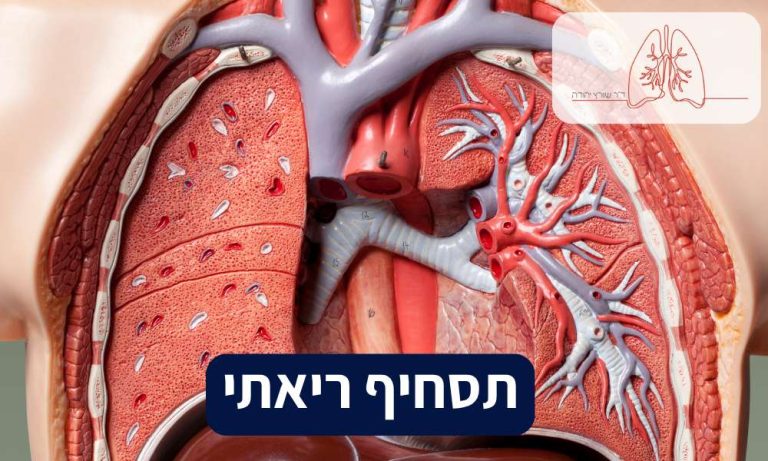 תסחיף ריאתי